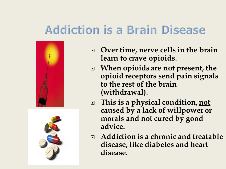 Addiction is a Brain Disease